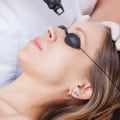 Is Laser Hair Removal Safe Around Eyes? - An Expert's Perspective