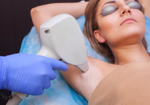 How Long Does Laser Hair Removal Last? A Comprehensive Guide